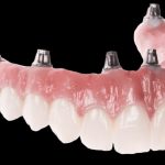 Information About Dental Treatments, Devices, Specialties, And Conditions